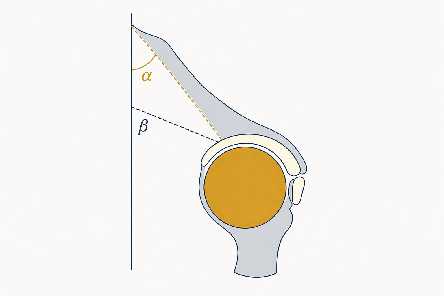 Schema degli angoli α (alfa) e β (beta) di Graf nell'ecografia dell'anca neonatale